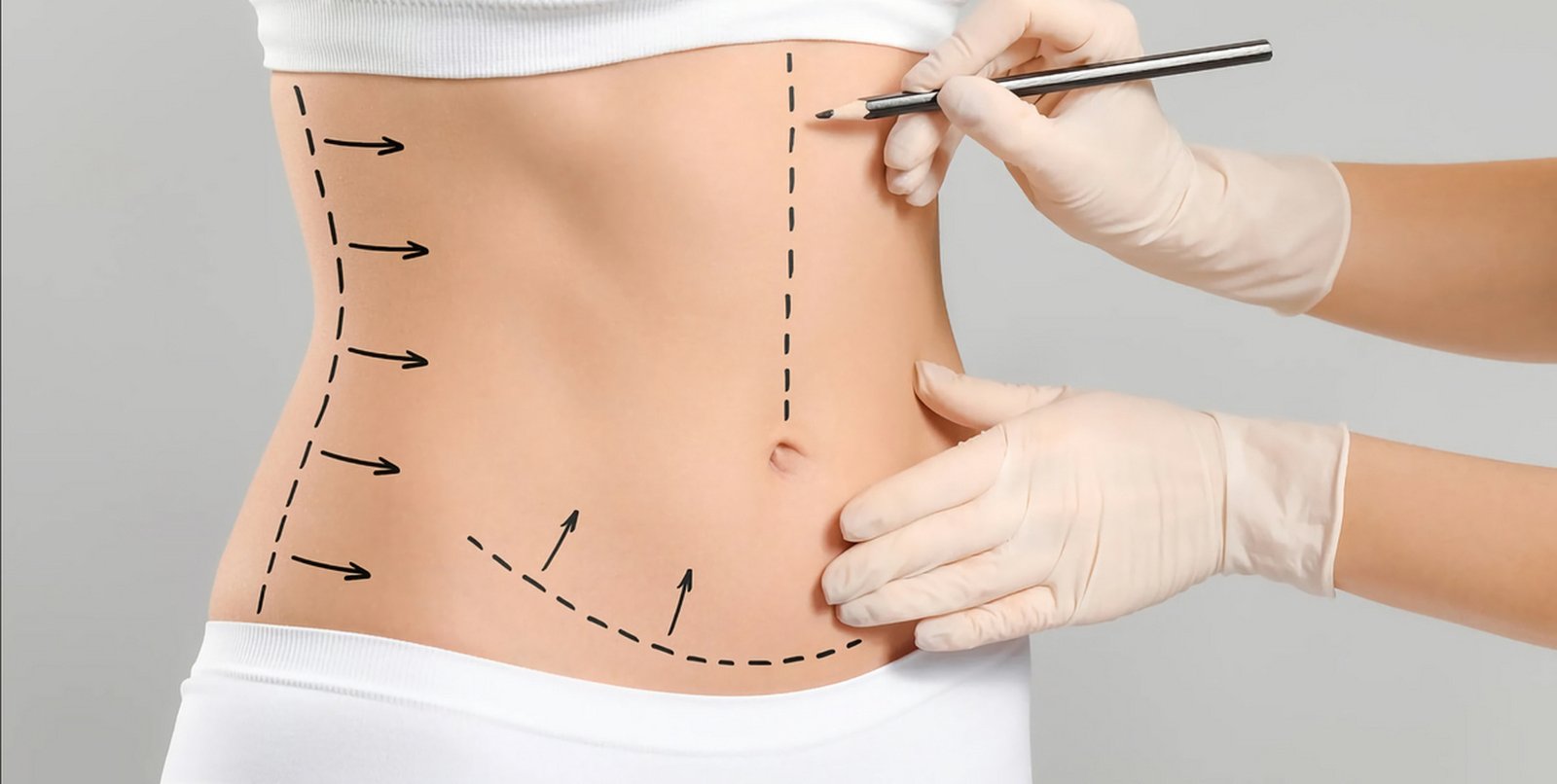 Liposuction body contouring at Luxxery Waldorf MD