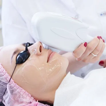 IPL therapy non surgical