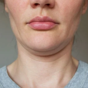 half face with sagging skin and double chin