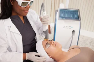 Cutera xeo facial vein treatment