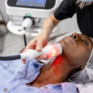 non surgical neck lift procedure