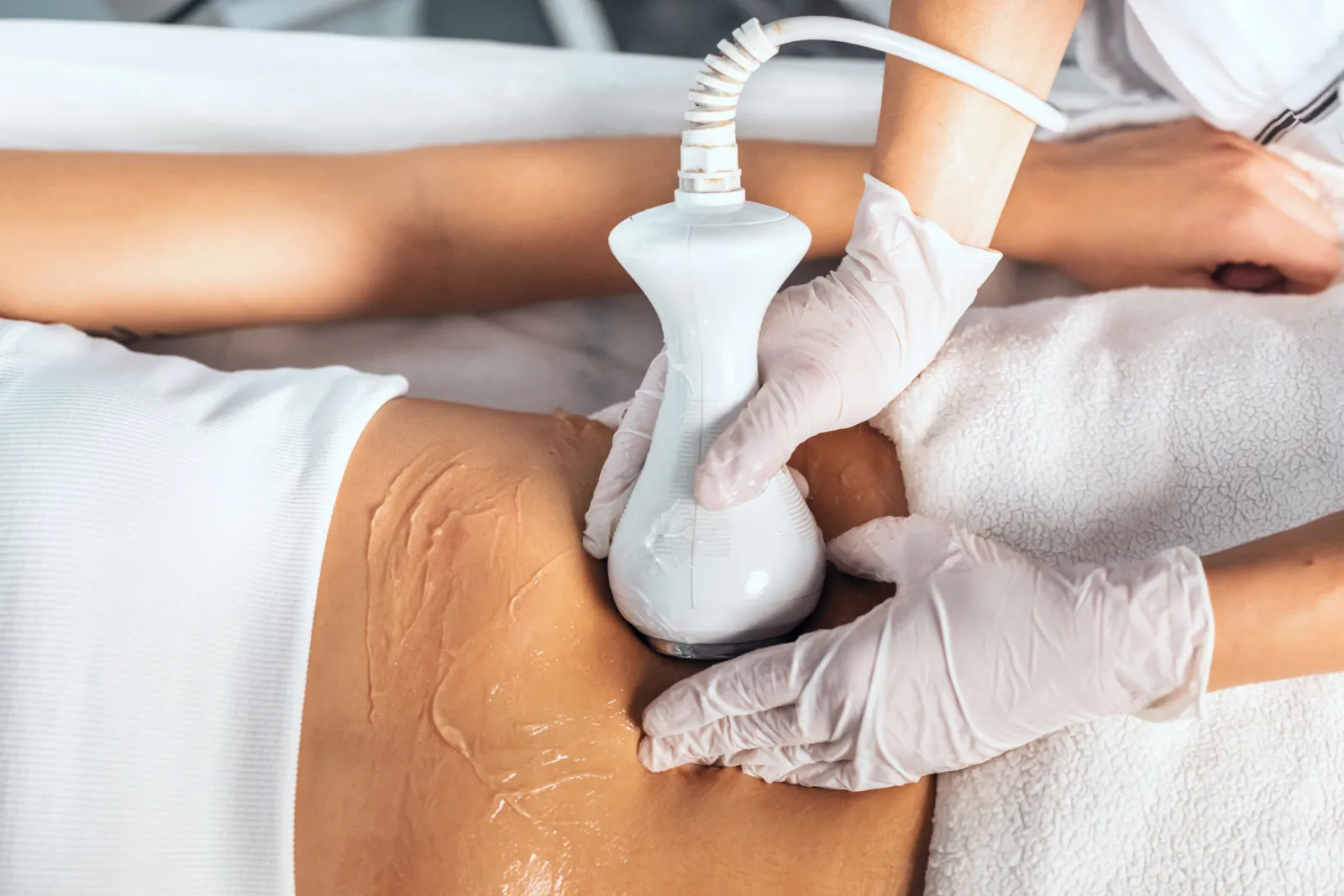 BodyTite radiofrequency body contouring Luxxery Waldorf