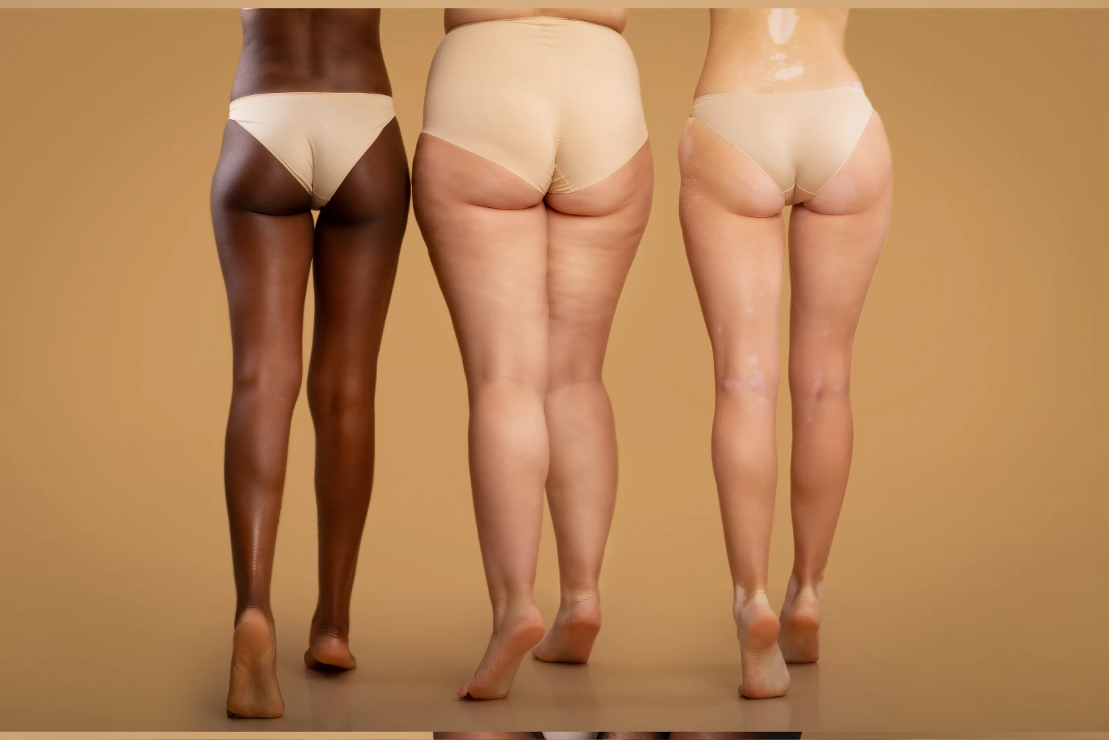Lower body lift surgery patient — Luxxery Boutique body contouring in Waldorf MD