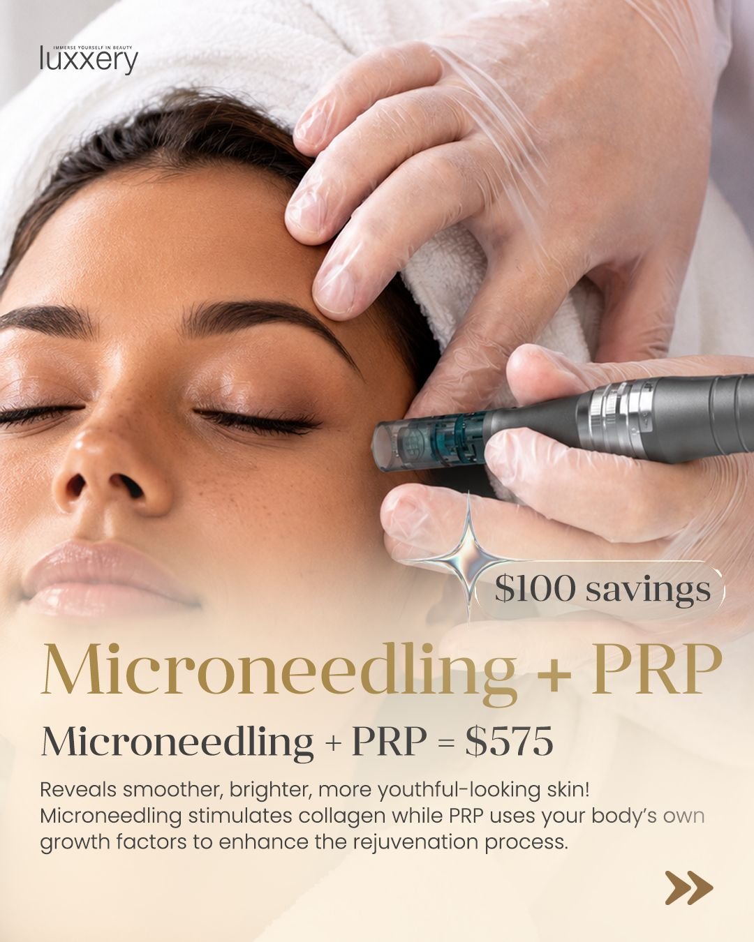 Microneedling + PRP — $575, save $100